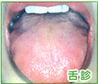 サンプル画像